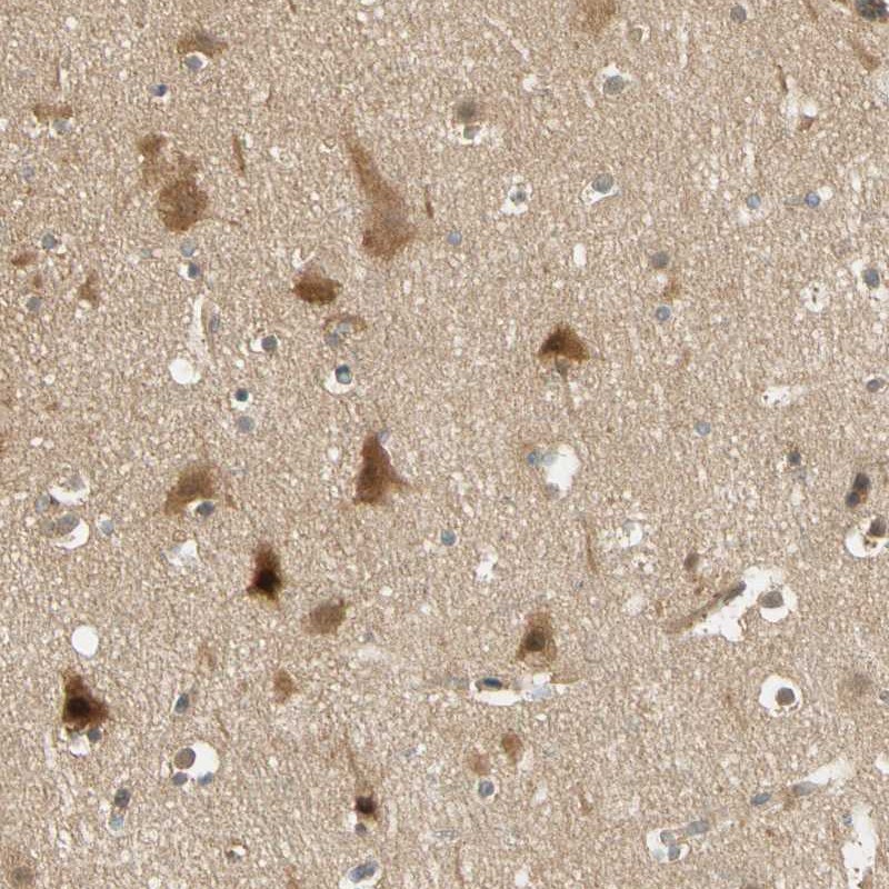 Anti-PDDC1 Antibody