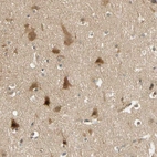 Anti-PDDC1 Antibody
