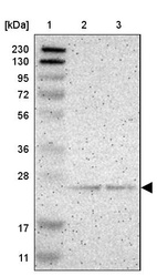 Anti-PDDC1 Antibody