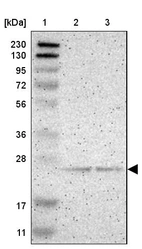 Lane 1: Marker [kDa] 230, 130, 95, 72, 56, 36, 28, 17, 11_br/_Lane 2: Human cell line RT-4_br/_Lane 3: Human cell line U-251MG sp