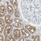 Immunohistochemical staining of human kidney shows moderate cytoplasmic positivity in cells in tubules.