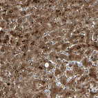 Immunohistochemical staining of human liver shows strong cytoplasmic positivity in hepatocytes.
