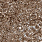 Immunohistochemical staining of human liver shows strong cytoplasmic positivity in hepatocytes.