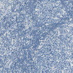 Immunohistochemical staining of human lymph node shows no positivity in germinal center cells as expected.