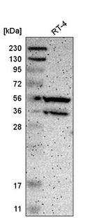 Anti-PPP3CB Antibody