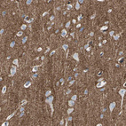 Immunohistochemical staining of human cerebral cortex shows strong positivity in neuropil.