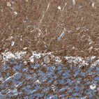 Immunohistochemical staining of human cerebellum shows strong positivity in neuronal processes.