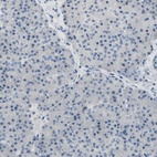 Anti-NFASC Antibody