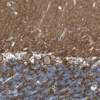 Immunohistochemical staining of human cerebellum shows strong positivity in neuronal processes.