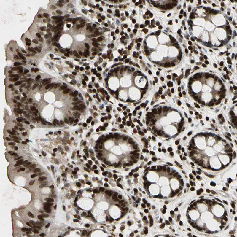 Anti-TSHZ3 Antibody