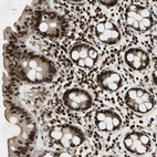 Anti-TSHZ3 Antibody
