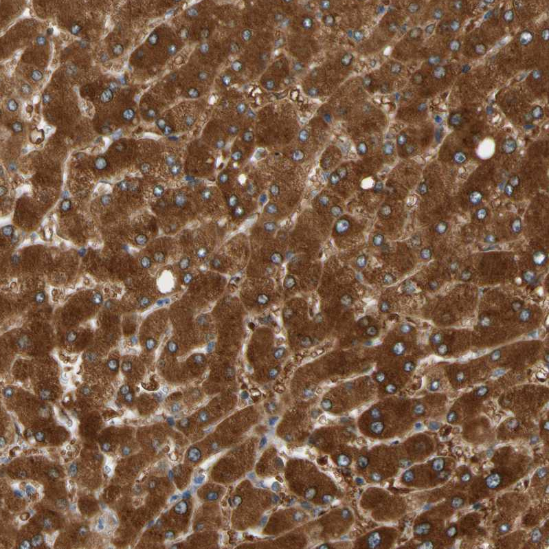 Anti-PARP14 Antibody