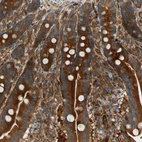 Immunohistochemical staining of human duodenum shows strong cytoplasmic positivity in glandular cells.