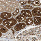 Immunohistochemical staining of human kidney shows strong cytoplasmic positivity in cells in tubules.