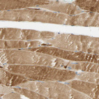Immunohistochemical staining of human skeletal muscle shows moderate cytoplasmic positivity in myocytes.