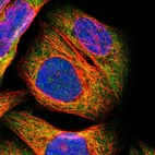 Immunofluorescent staining of human cell line A-431 shows localization to cytosol.