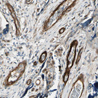 Immunohistochemical staining of human placenta shows moderate cytoplasmic positivity in endothelial cells.
