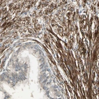 Immunohistochemical staining of human prostate shows strong membranous positivity in smooth muscle cells.