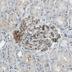 Immunohistochemical staining of human kidney shows moderate membranous positivity in cells in glomeruli.