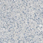 Immunohistochemical staining of human liver shows no positivity in hepatocytes as expected.