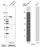 Western blot analysis in human cell lines SK-MEL-30 and MCF-7 using Anti-MCAM antibody. Corresponding MCAM RNA-seq data are presented for the same cell lines. Loading control: Anti-PFN1.
