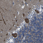 Anti-GRAMD1A Antibody