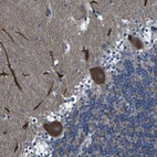 Anti-GRAMD1A Antibody
