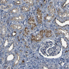 Immunohistochemical staining of human kidney shows moderate membranous positivity in cells in tubules.