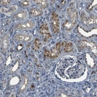 Immunohistochemical staining of human kidney shows moderate membranous positivity in cells in tubules.