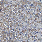 Immunohistochemical staining of human stomach shows moderate membranous and cytoplasmic positivity in glandular cells.