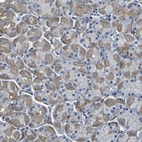 Immunohistochemical staining of human stomach shows moderate membranous and cytoplasmic positivity in glandular cells.