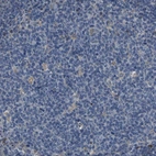 Immunohistochemical staining of human tonsil shows negative cytoplasmic positivity in germinal center cells as expected.
