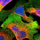 Immunofluorescent staining of human cell line U-2 OS shows localization to plasma membrane & cytosol.