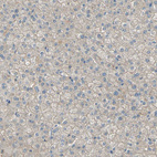 Immunohistochemical staining of human liver shows very weak membranous positivity in hepatocytes.