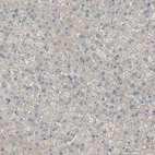 Immunohistochemical staining of human liver shows very weak membranous positivity in hepatocytes.