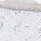 Immunohistochemical staining of human cervix, uterine shows weak membranous positivity in squamous epithelial cells.