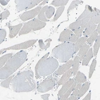 Immunohistochemical staining of human skeletal muscle shows no positivity in myocytes as expected.