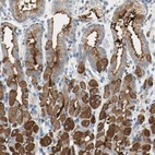 Anti-MUC1 Antibody