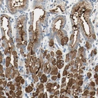 Immunohistochemical staining of human stomach shows high expression.