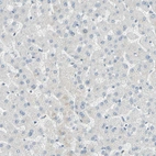 Immunohistochemical staining of human liver shows low expression as expected.