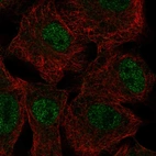 Anti-SGK2 Antibody