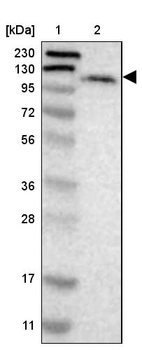 Lane 1: Marker [kDa] 230, 130, 95, 72, 56, 36, 28, 17, 11_br/_Lane 2: Human cell line RT-4