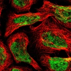 Immunofluorescent staining of human cell line A-431 shows localization to nucleus.