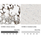 Anti-CCNB2 Antibody