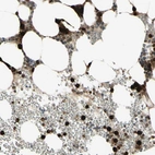 Immunohistochemical staining of human bone marrow shows high expression.