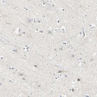 Immunohistochemical staining of human cerebral cortex shows low expression as expected.