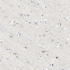 Immunohistochemical staining of human cerebral cortex shows low expression as expected.
