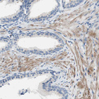 Immunohistochemical staining of human prostate shows moderate cytoplasmic positivity in smooth muscle cells.