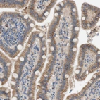 Immunohistochemical staining of human duodenum shows weak to moderate cytoplasmic/ membranous positivity in glandular cells.
