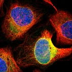 Immunofluorescent staining of human cell line U-2 OS shows localization to endoplasmic reticulum.